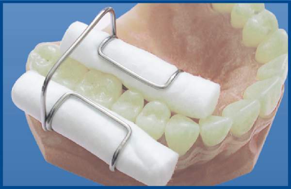 Валикодержатель 1.010 шт. N1